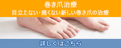 巻き爪治療